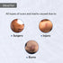 Fixderma Skincare Scar Gel For Scars